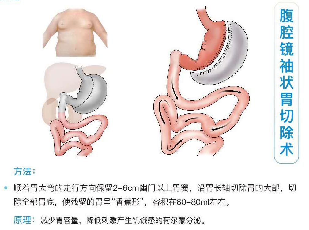 甲乳代謝外科