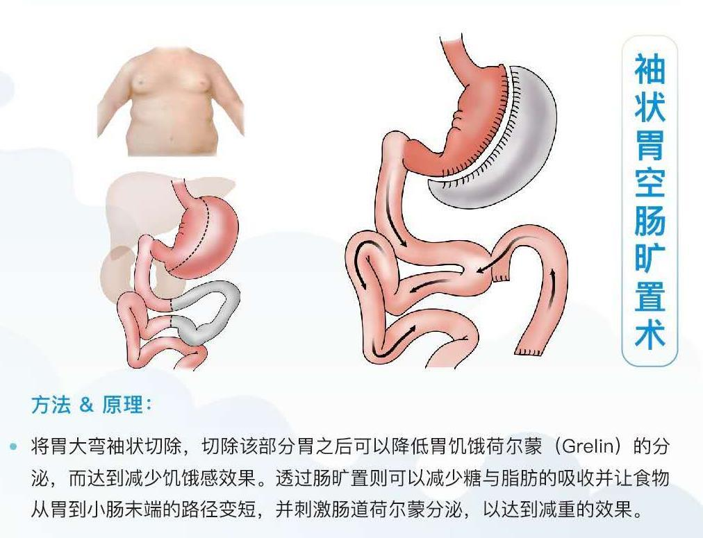 甲乳代謝外科