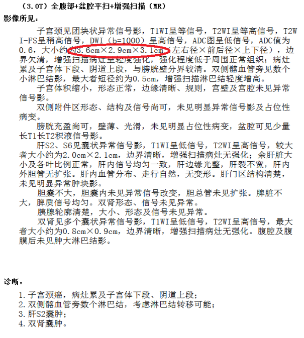 腫瘤治療不要輸在起跑線上(shàng) 腫瘤治療不要輸在起跑線上(shàng)