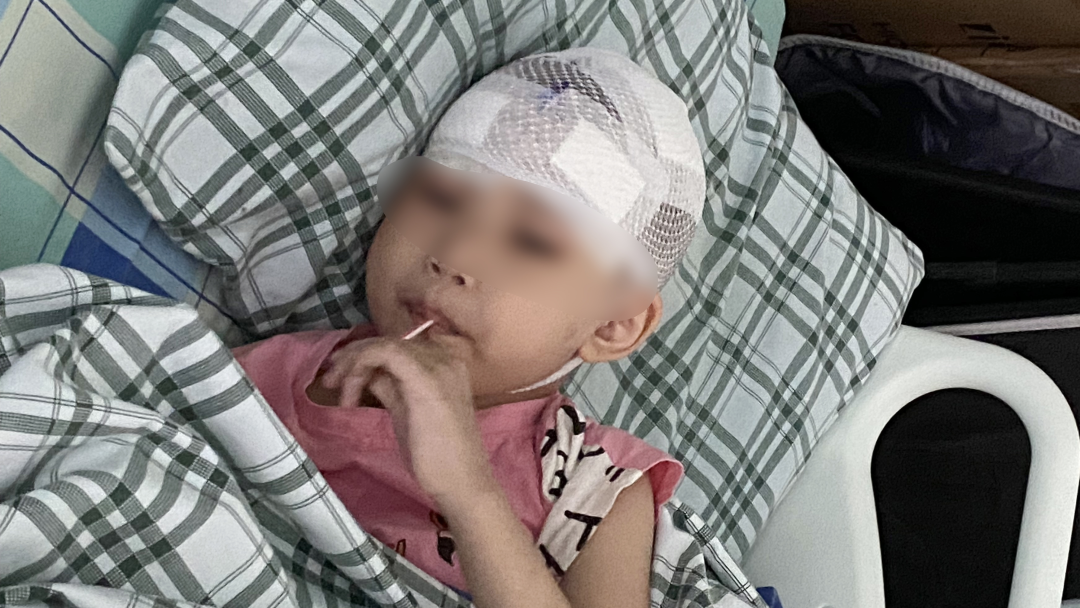 7歲小(xiǎo)女孩患腦(nǎo)膠質瘤并發癫痫症,神經醫(yī)學專家(jiā)專業化治療,圓滿成功! 7歲小(xiǎo)女孩患腦(nǎo)膠質瘤并發癫痫症,神經醫(yī)學專家(jiā)專業化治療,圓滿成功!