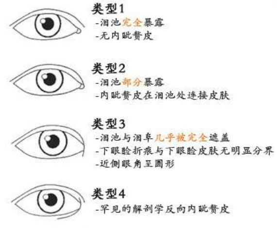 大(dà)衆科普|眼周美容微整形攻略,請(qǐng)您查收~ 大(dà)衆科普|眼周美容微整形攻略,請(qǐng)您查收~