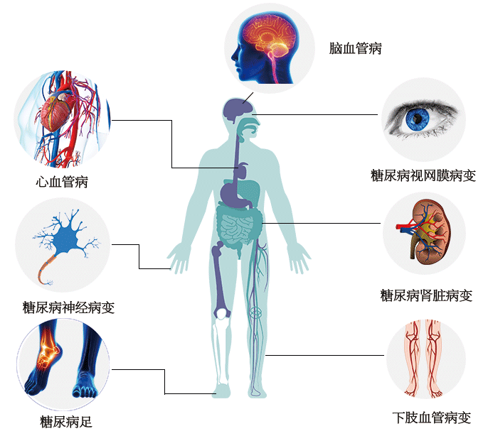 世界防治糖尿病日|了解風險,了解應對 世界防治糖尿病日|了解風險,了解應對